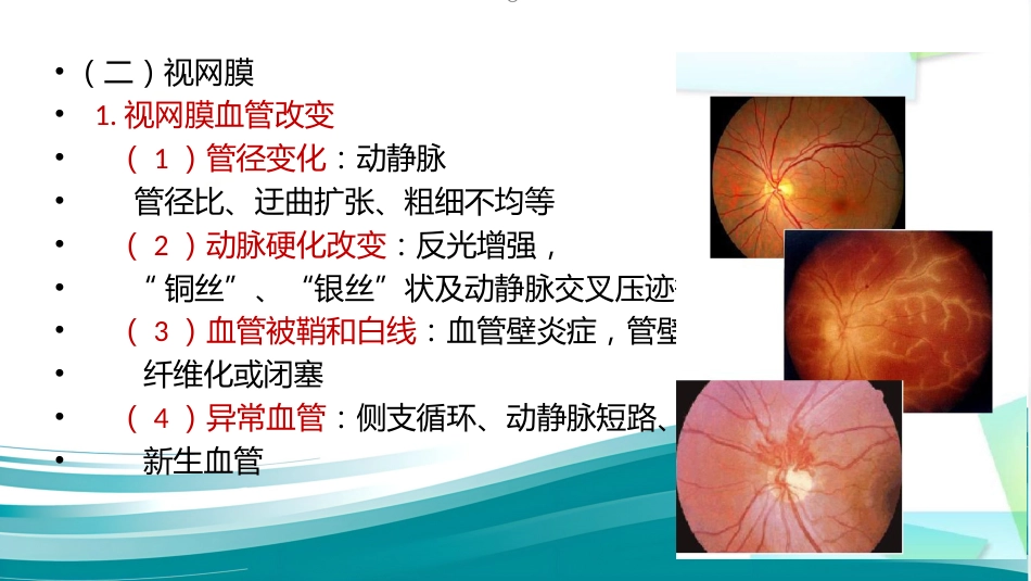 常见眼底病基础知识_第14页