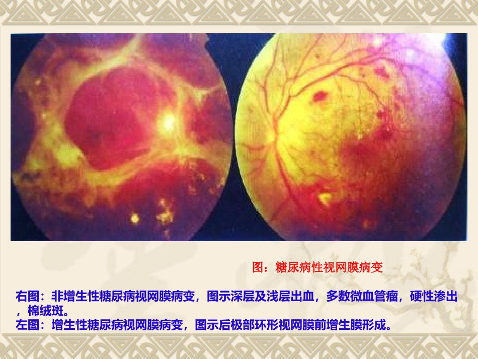常见全身疾病的眼部表现_第13页