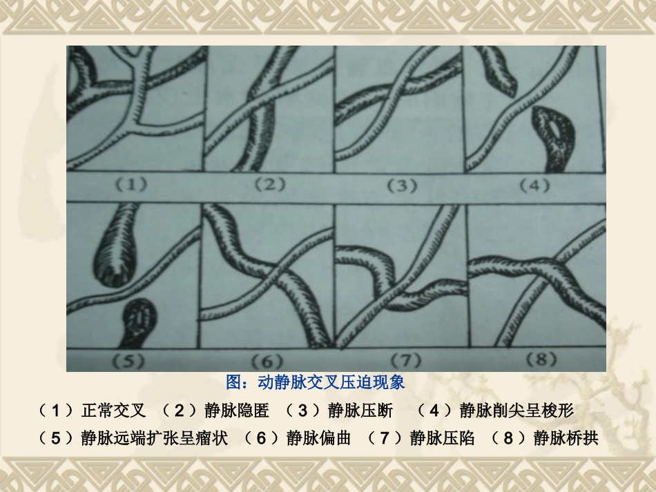 常见全身疾病的眼部表现_第5页