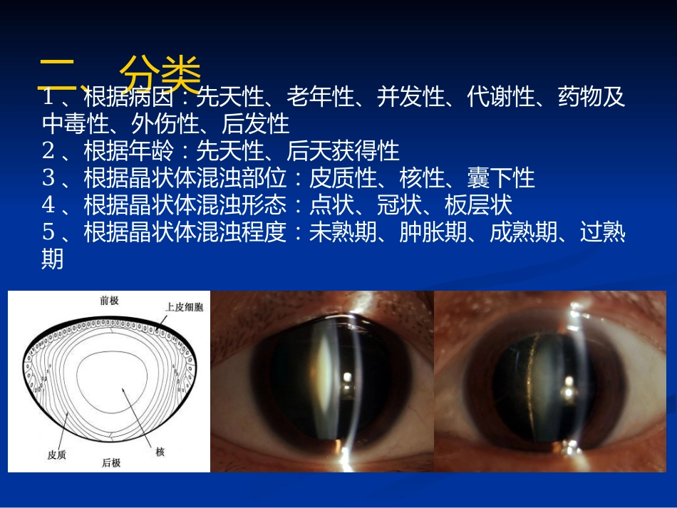 白内障_1_第7页