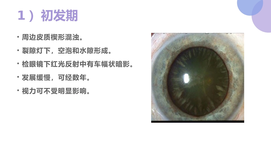 白内障的诊断与治疗(1)_第12页