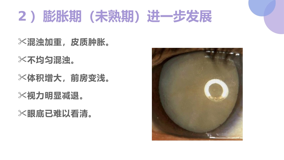 白内障的诊断与治疗(1)_第14页