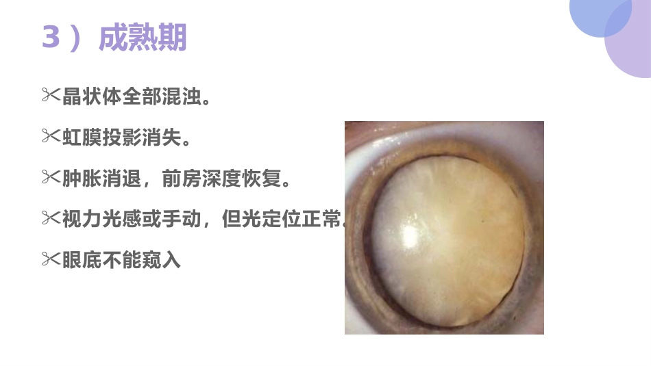 白内障的诊断与治疗(1)_第15页