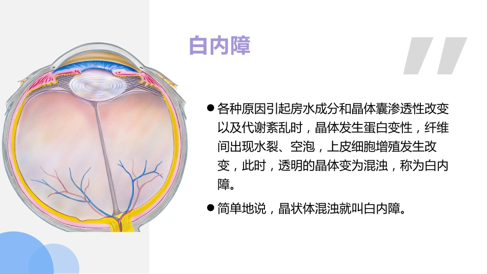 白内障的诊断与治疗(1)_第3页