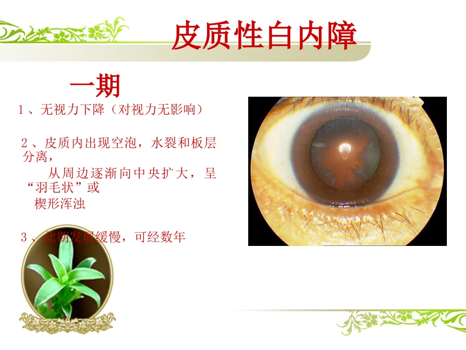 白内障(1)_第15页