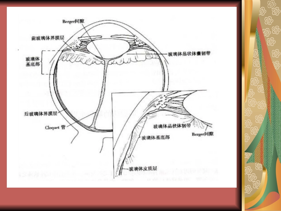 玻璃体疾病(1)_第3页