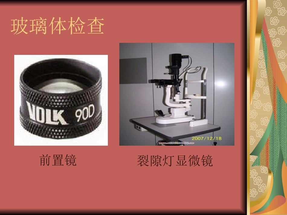玻璃体疾病(1)_第8页