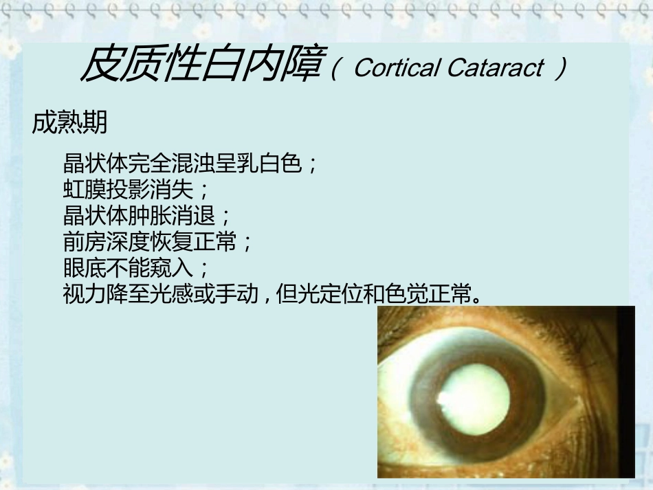 白内障(2)_第15页