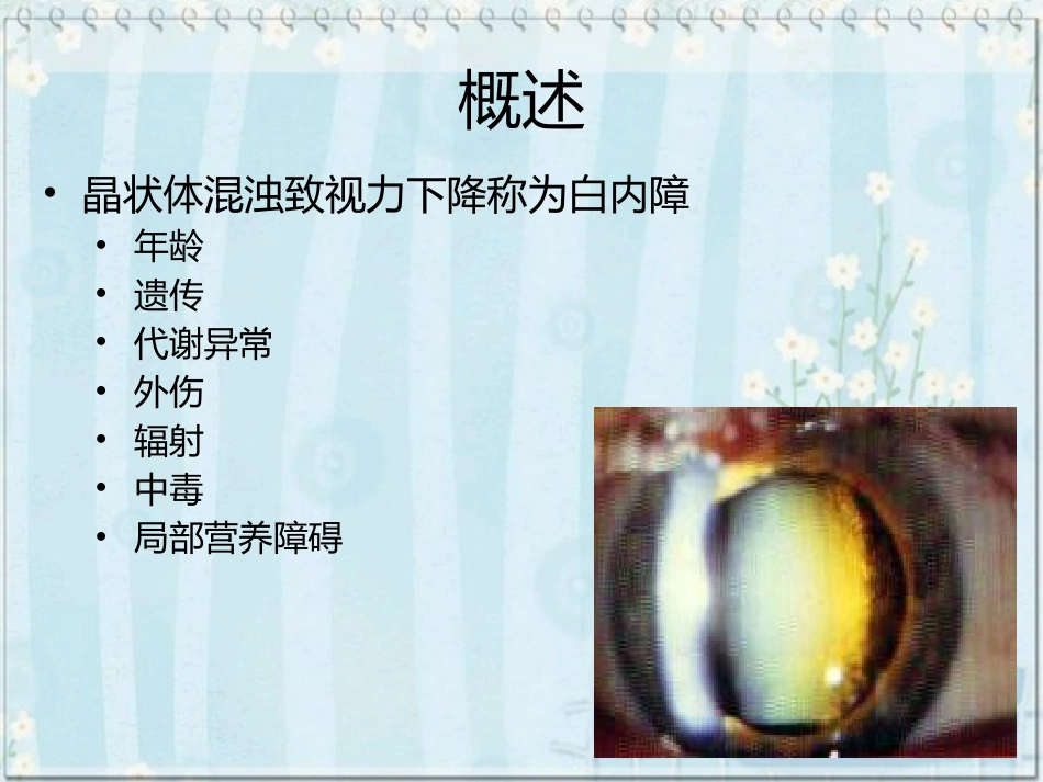 白内障(2)_第3页