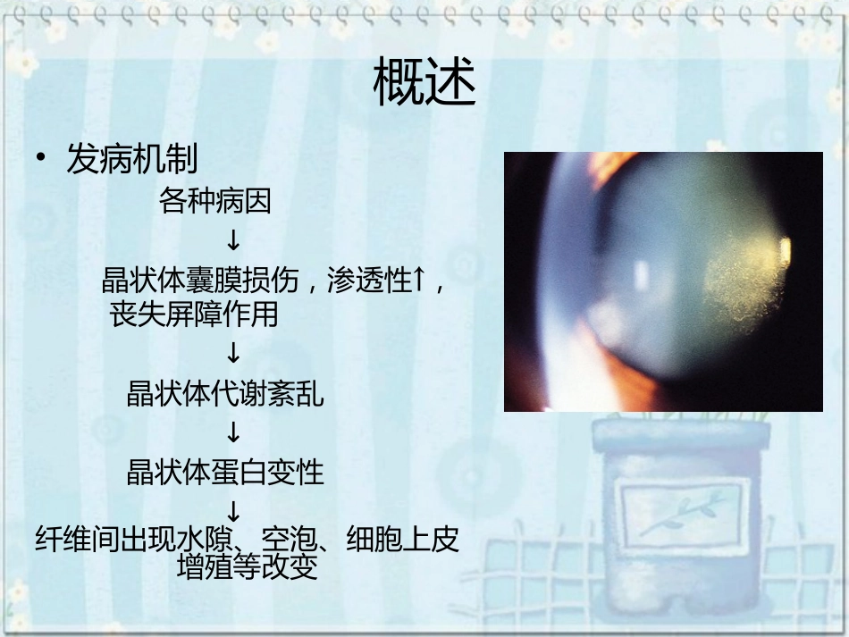 白内障(2)_第4页