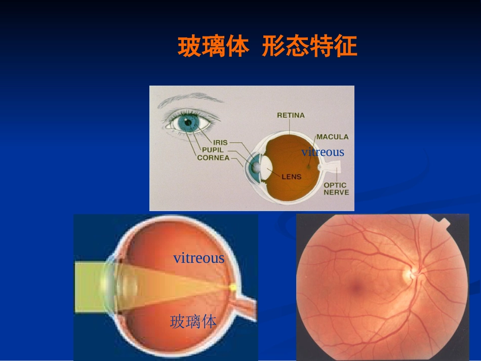 玻璃体病 (2)_第3页
