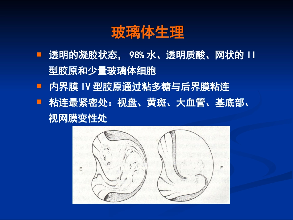 玻璃体病 (2)_第4页