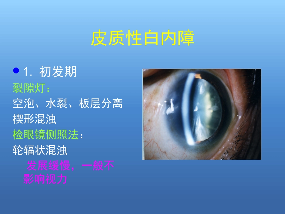 白内障的诊断与治疗(2)_第10页