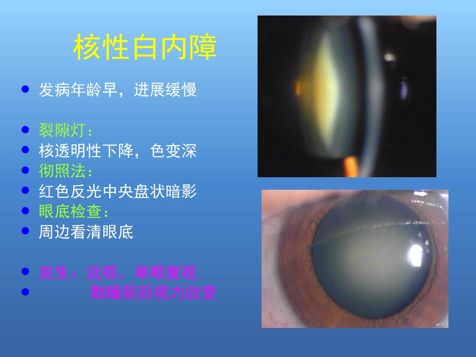 白内障的诊断与治疗(2)_第14页