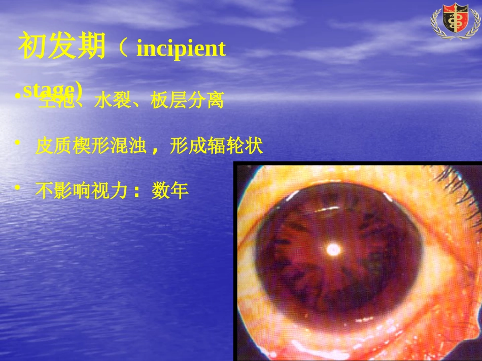 白内障(3)_第12页