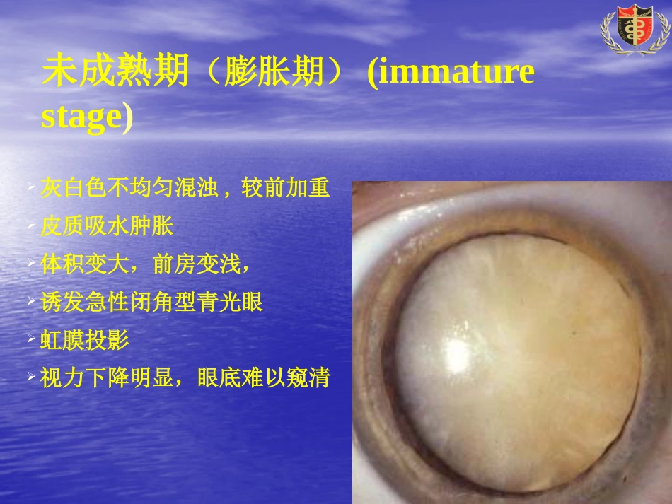 白内障(3)_第13页