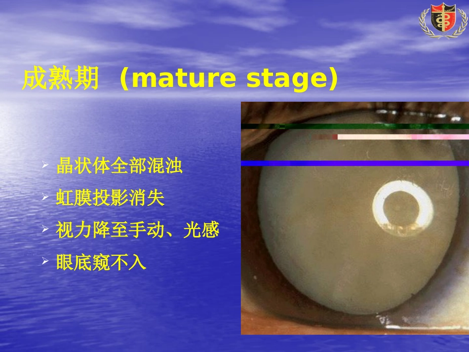 白内障(3)_第15页