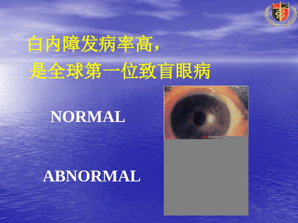 白内障(3)_第5页