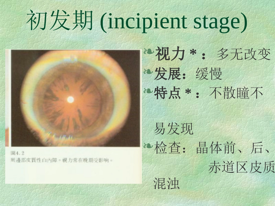 白内障(4)_第15页