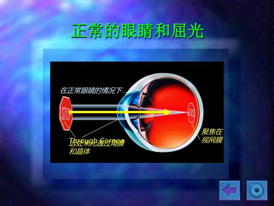 白内障(5)_第7页