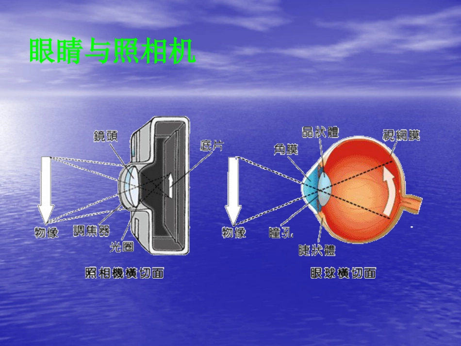 白内障(5)_第8页