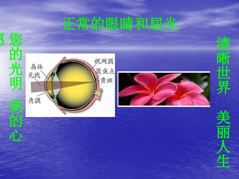 白内障(5)_第9页