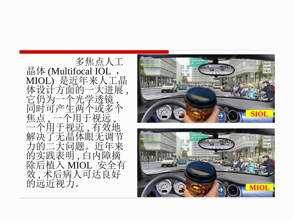 92217-白内障-多焦人工晶体_第3页