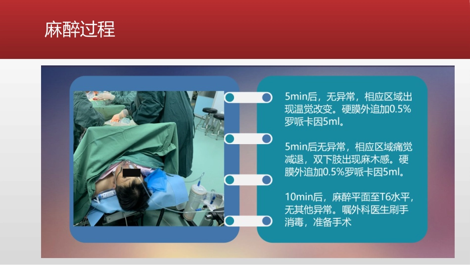 艾司氯胺酮产科麻醉分析_第5页