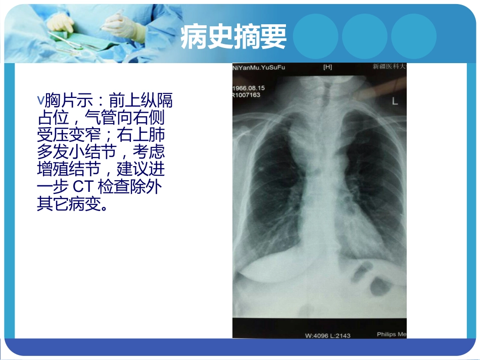 《巨大甲状腺肿麻醉》PPT课件_第4页