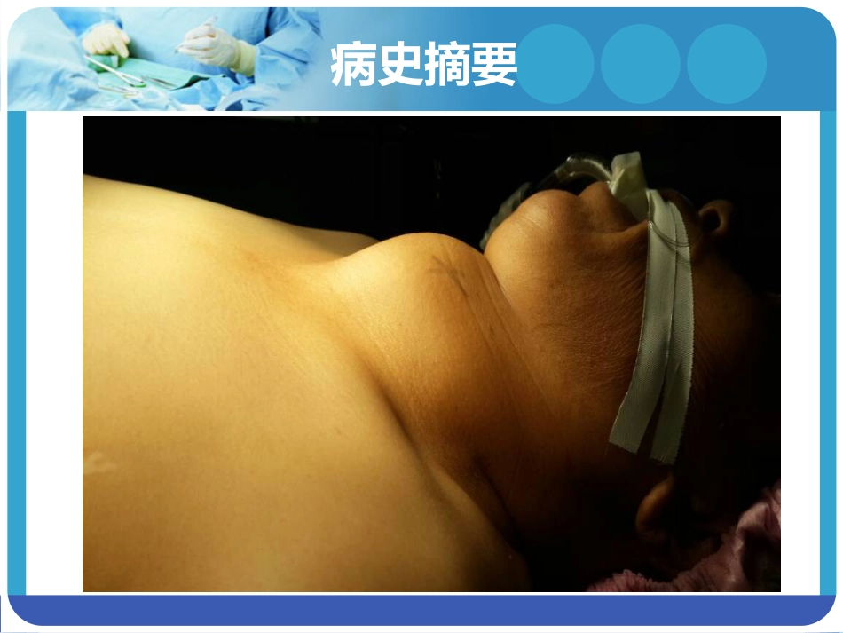 《巨大甲状腺肿麻醉》PPT课件_第9页