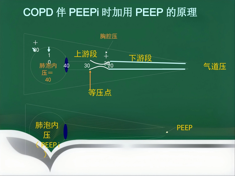 COPD患者的麻醉_第9页
