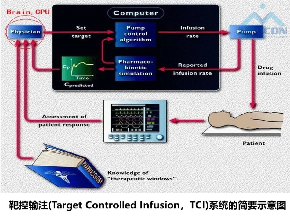 闭环靶控在麻醉中的应用_第4页