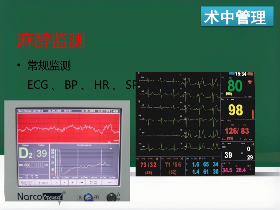 ERAS麻醉管理_第11页