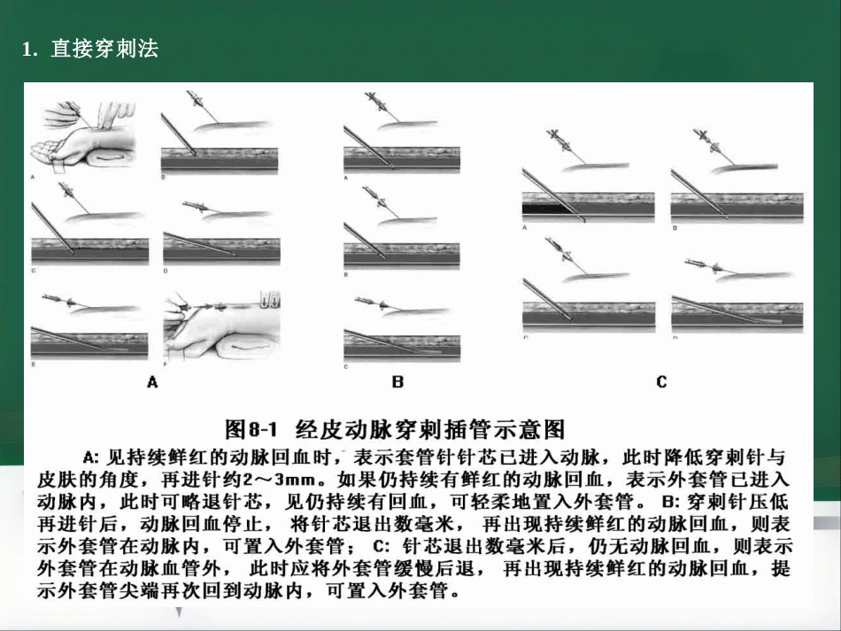 部分麻醉共识_第12页