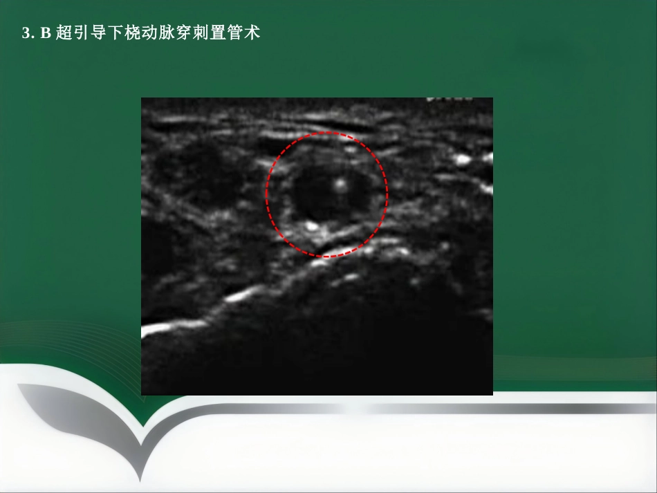 部分麻醉共识_第14页