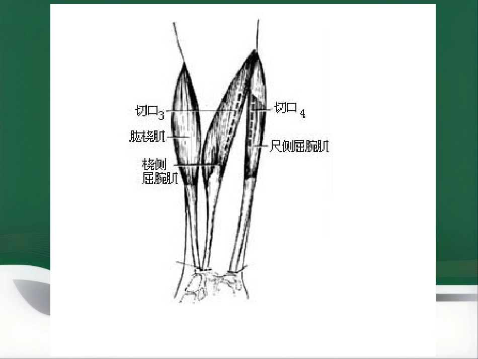 部分麻醉共识_第3页