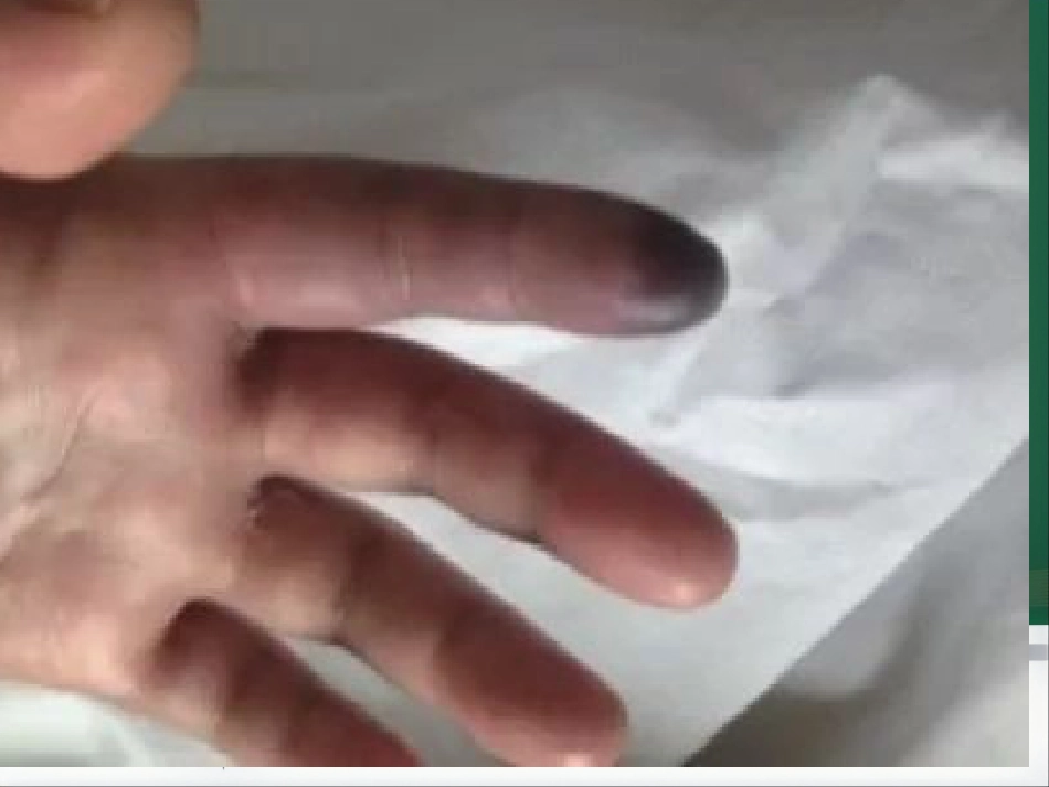 部分麻醉共识_第7页