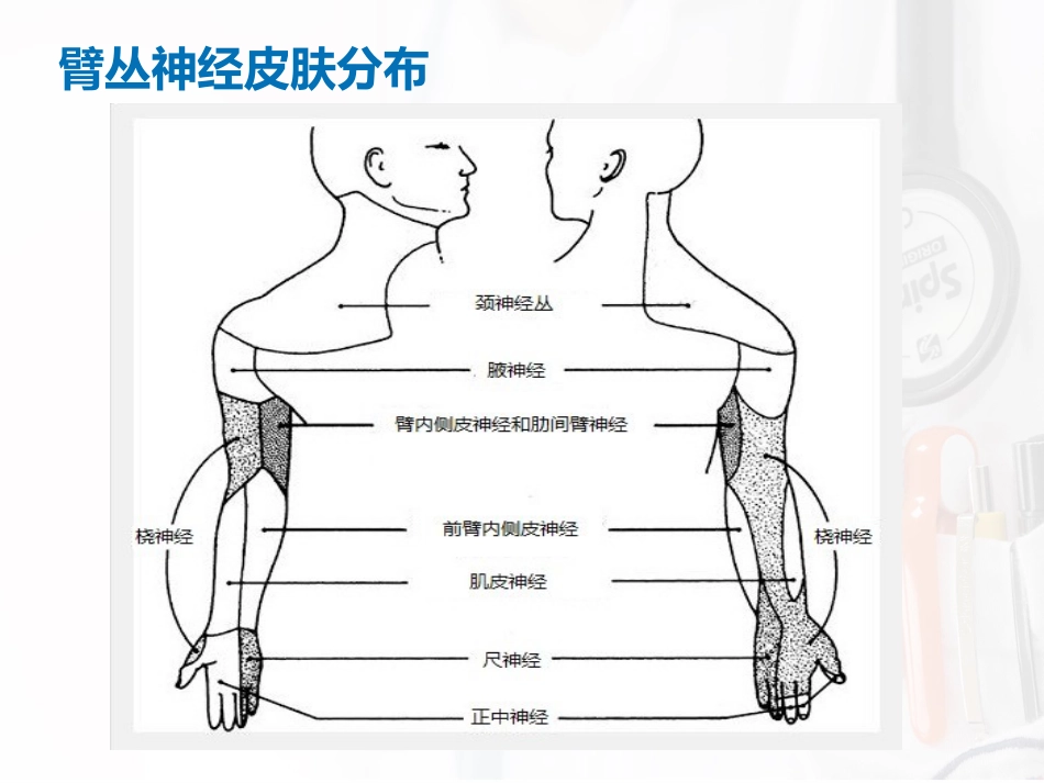 臂丛神经阻滞麻醉_第6页