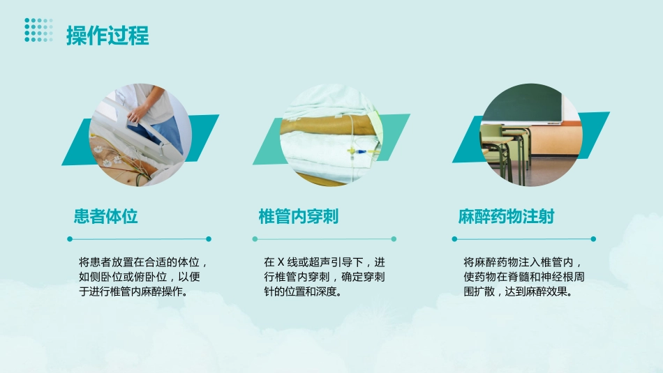《椎管内麻醉》PPT课件_第13页