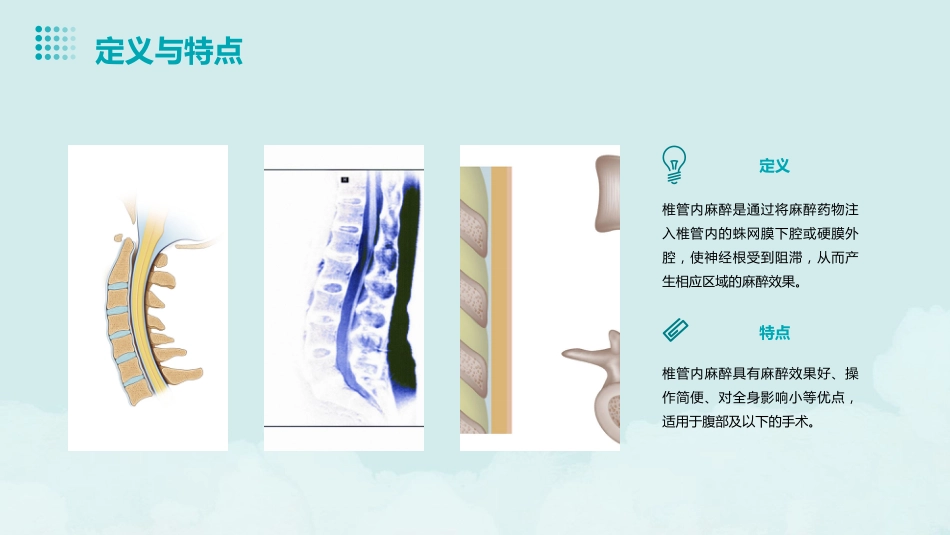 《椎管内麻醉》PPT课件_第4页