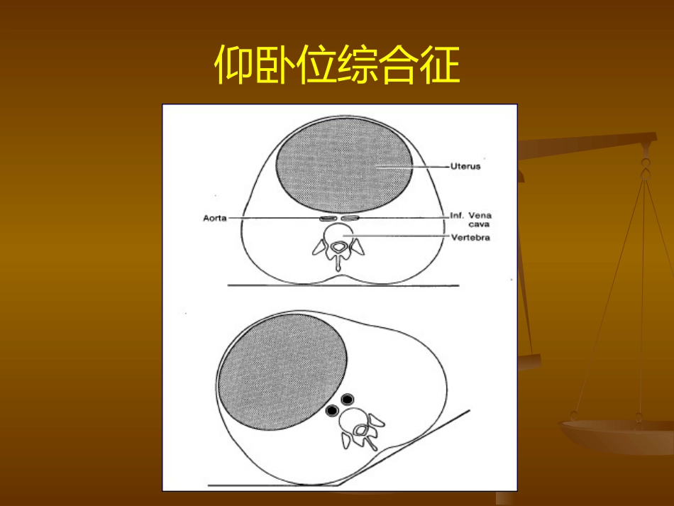 产科麻醉处理_第8页