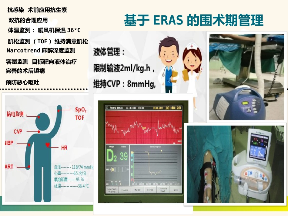 【麻醉技能学习】精准麻醉和ERAS 一例冠脉支架术后患者围术期麻醉管理_第8页