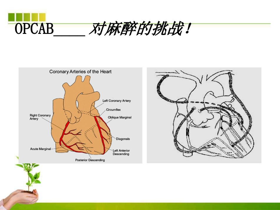不停跳冠脉搭桥手术血流动力学监测及麻醉管理ppt课件_第7页