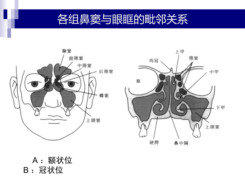 鼻、鼻窦和头颈部肿瘤的麻醉处理PPT_第3页