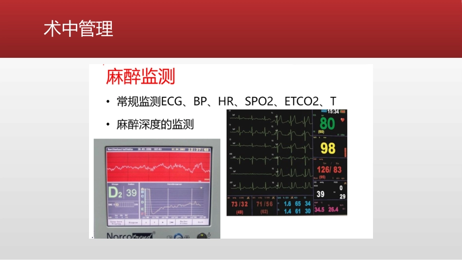 ERAS麻醉管理-精准麻醉_第11页