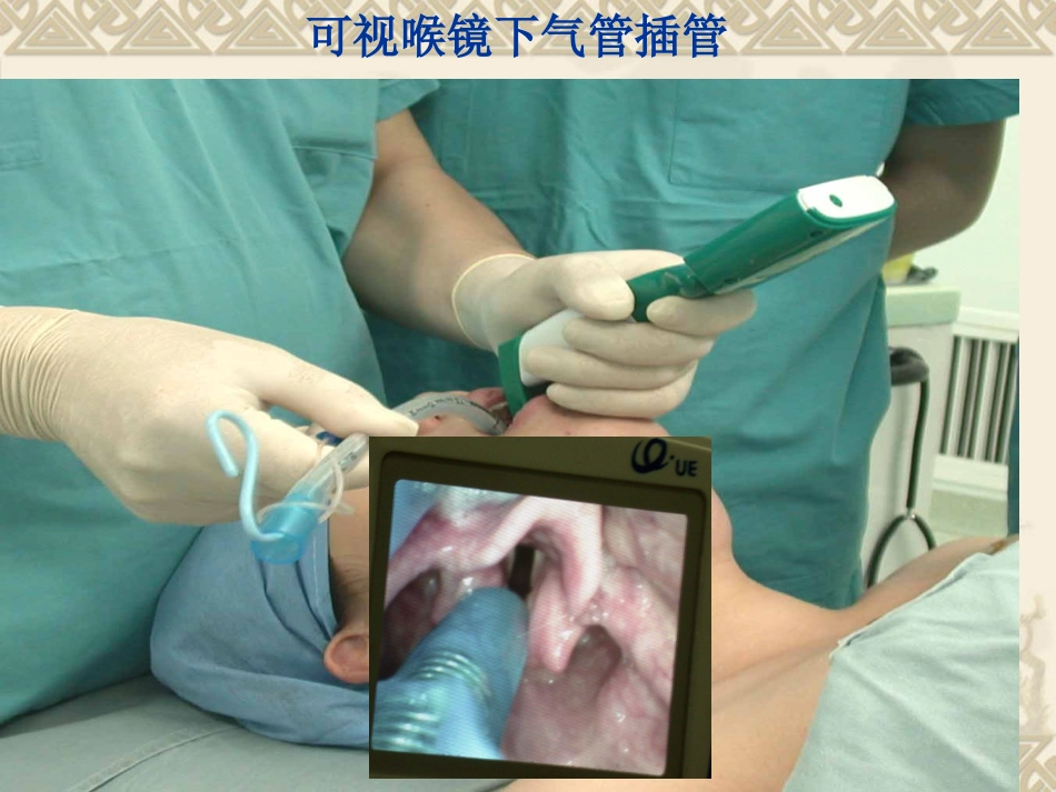 产科全身麻醉(1)_第7页