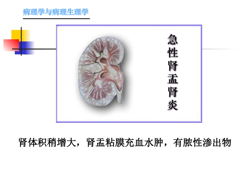 肾内科-肾盂肾炎1_第7页