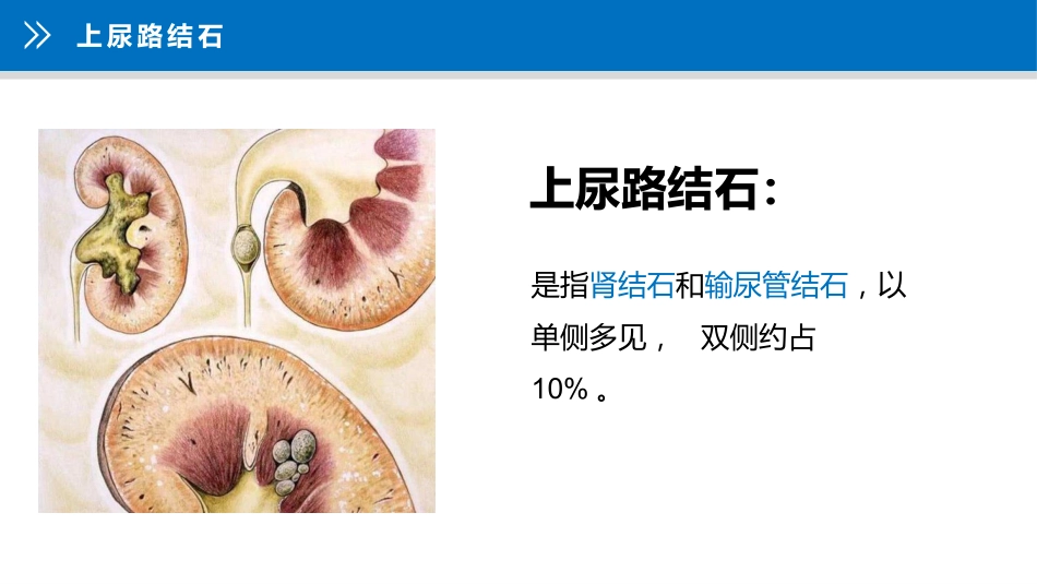 上尿路结石护理疑难病例讨论_第10页