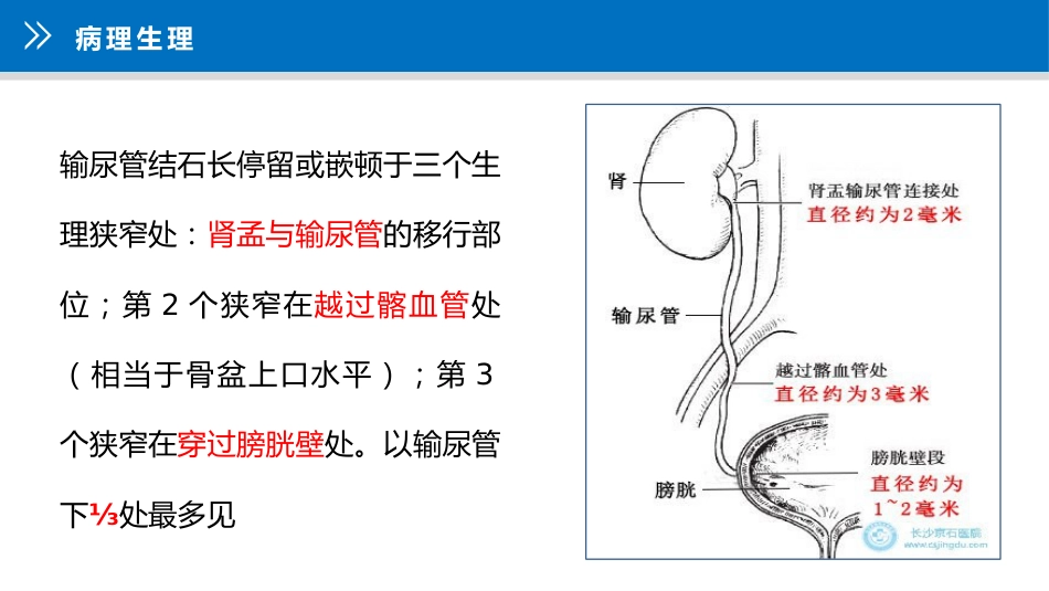 上尿路结石护理疑难病例讨论_第14页