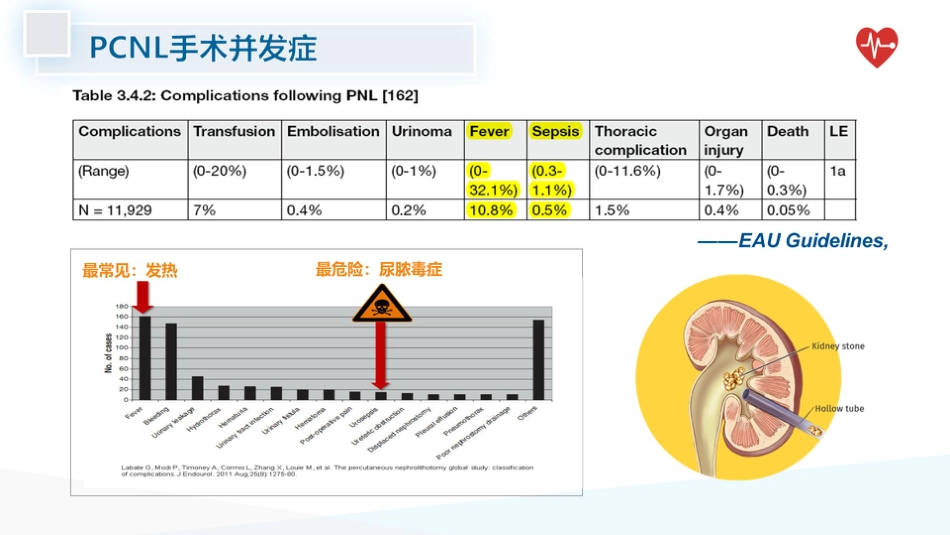 泌尿系统结石术后感染预防_第3页
